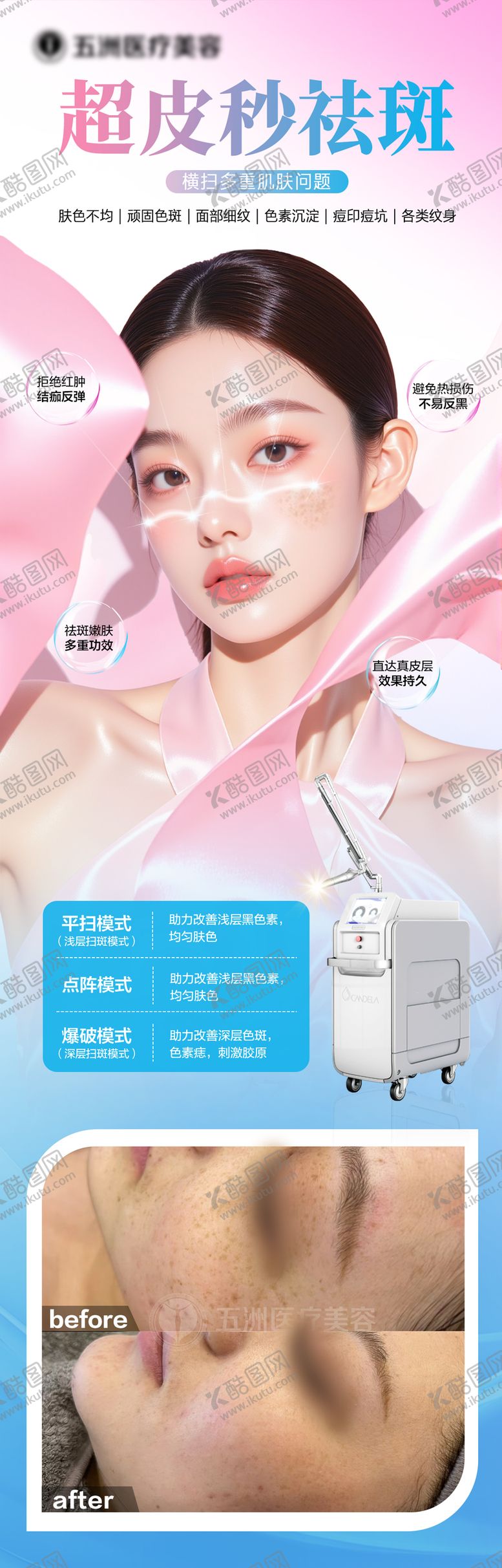 编号：94407809072222071745【酷图网】源文件下载-美白祛斑超皮秒案例长图海报