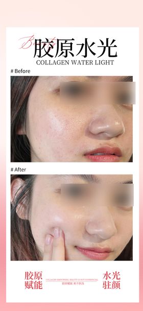 医美胶原水光案例海报