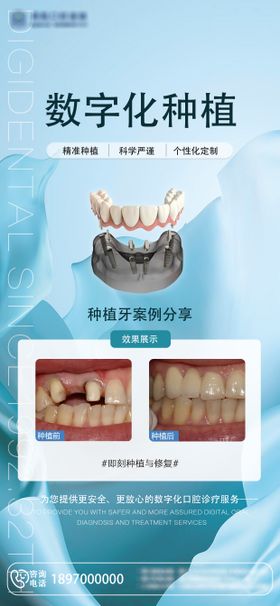 数字化种植病例海报