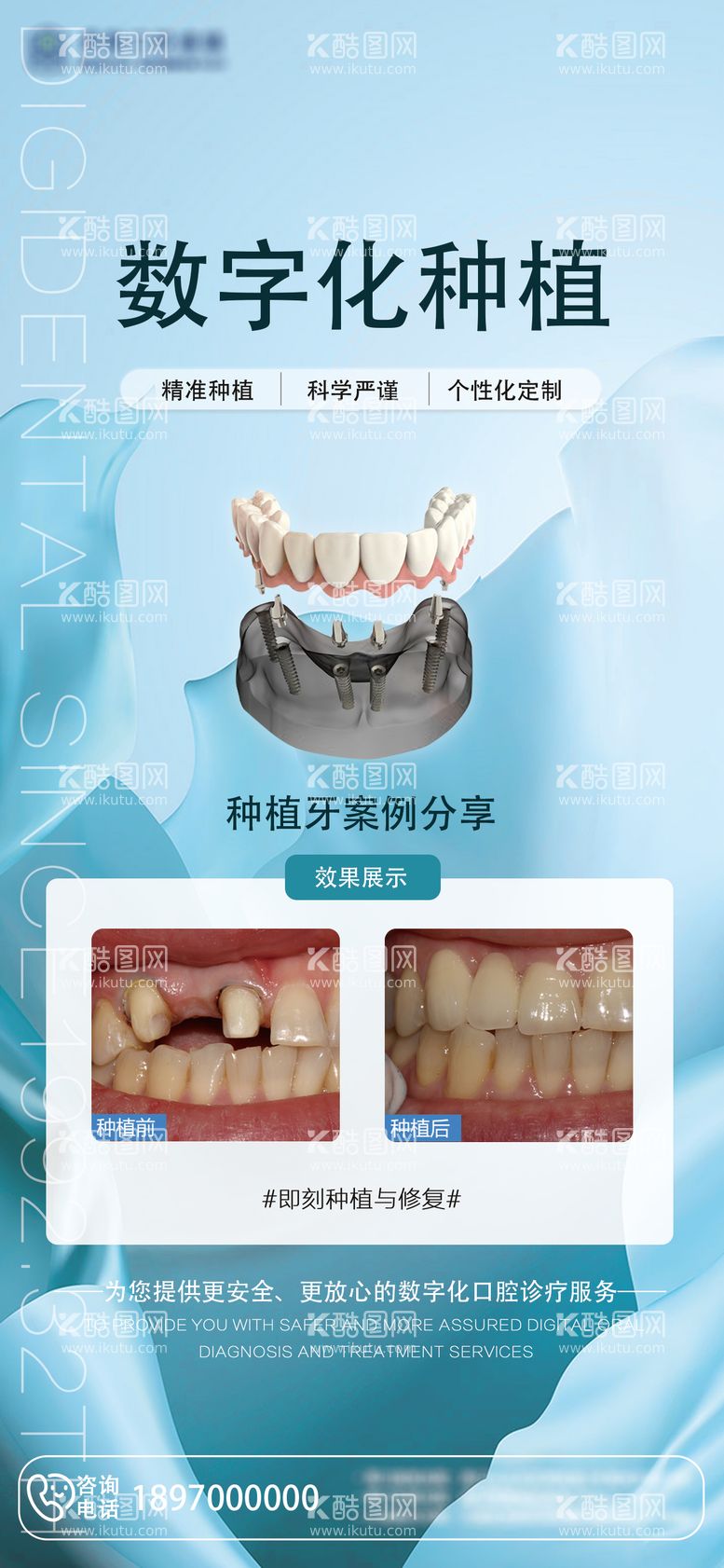 编号：36304912012346448693【酷图网】源文件下载-数字化种植病例海报