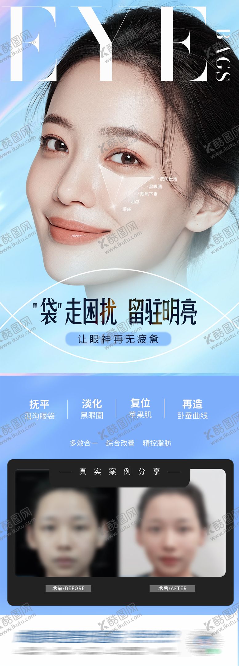 编号：71975803071903305710【酷图网】源文件下载-医美午休式祛眼袋案例创意海报