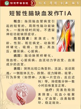 短暂性脑缺血发作TIA