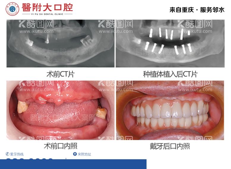 编号：26393411251816194416【酷图网】源文件下载-口腔案例