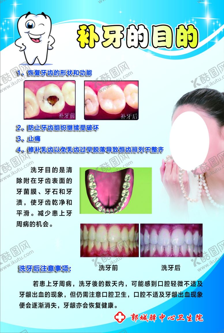 编号：71344910181804451710【酷图网】源文件下载-补牙的目的