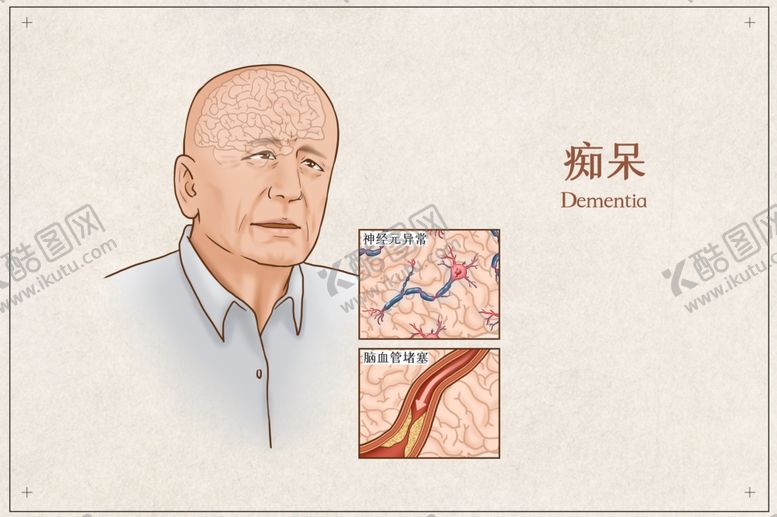 编号：25756112180056426022【酷图网】源文件下载-痴呆