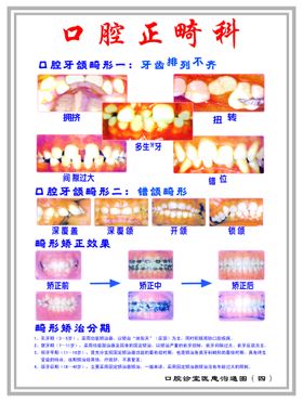 口腔展板