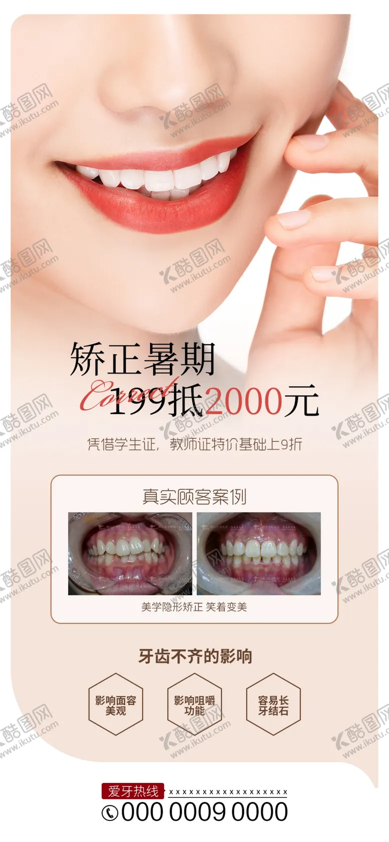 编号：05481909240542234537【酷图网】源文件下载-牙齿矫正