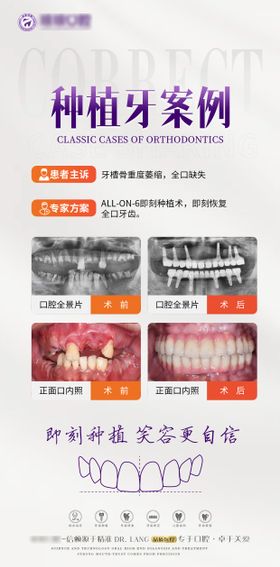 口腔案例种植牙海报