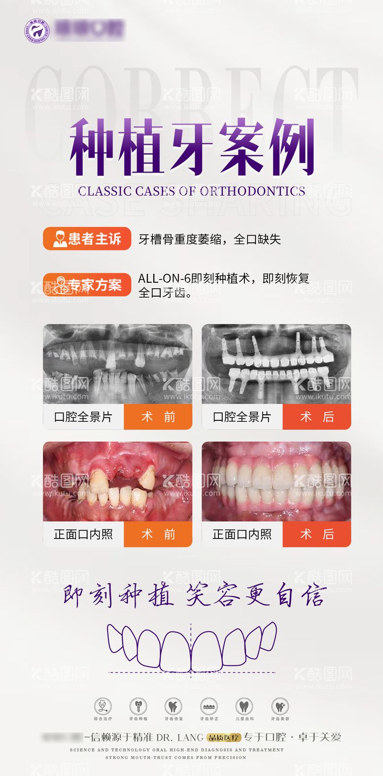 编号：34657211241231097564【酷图网】源文件下载-口腔种植牙案例对比海报