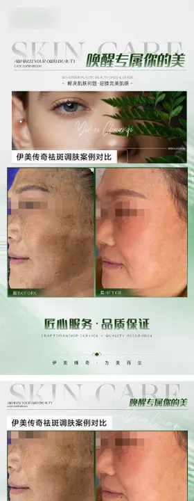 医美疫情在家皮肤状态卡通对比图系列海