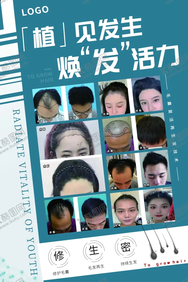 编号：35165911252048411775【酷图网】源文件下载-医疗植发海报