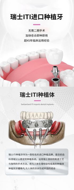 种植牙长图落地页