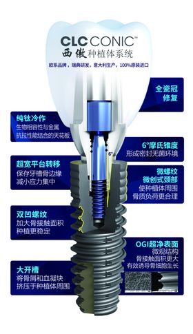 镶牙小知识