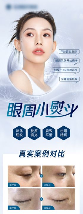 眼周小熨斗海报长图