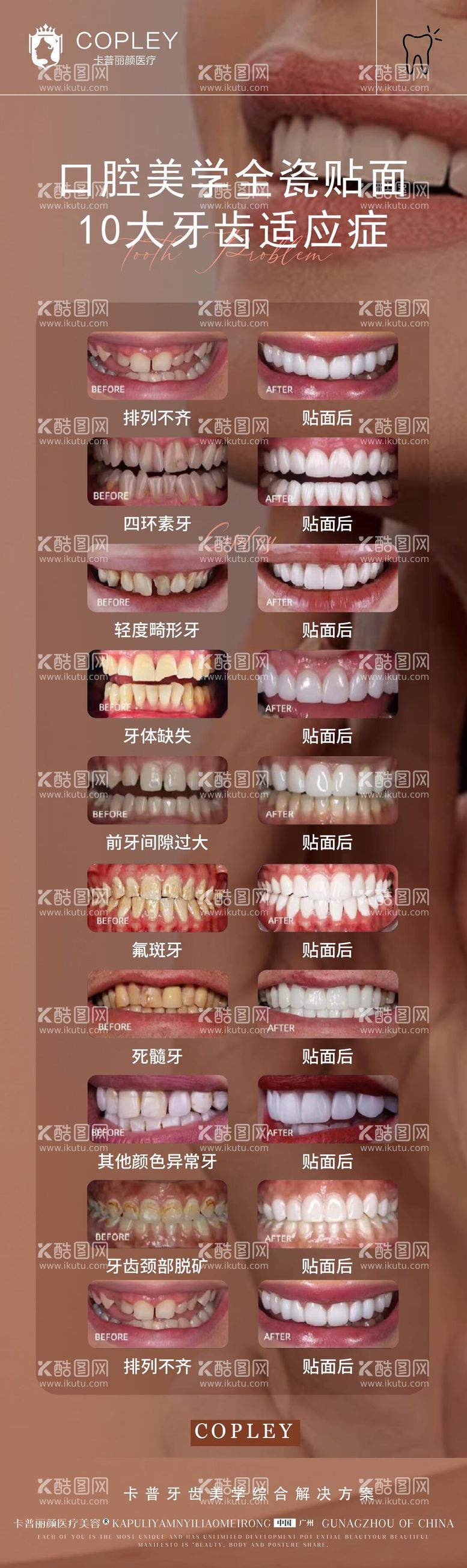 编号：36926103191530199876【酷图网】源文件下载-美学10大牙齿适应症海报