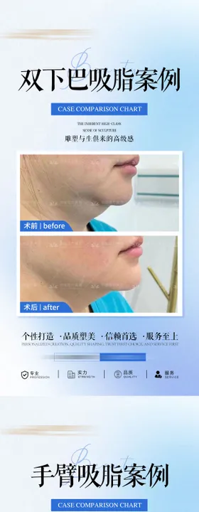 医美吸脂案例系列海报