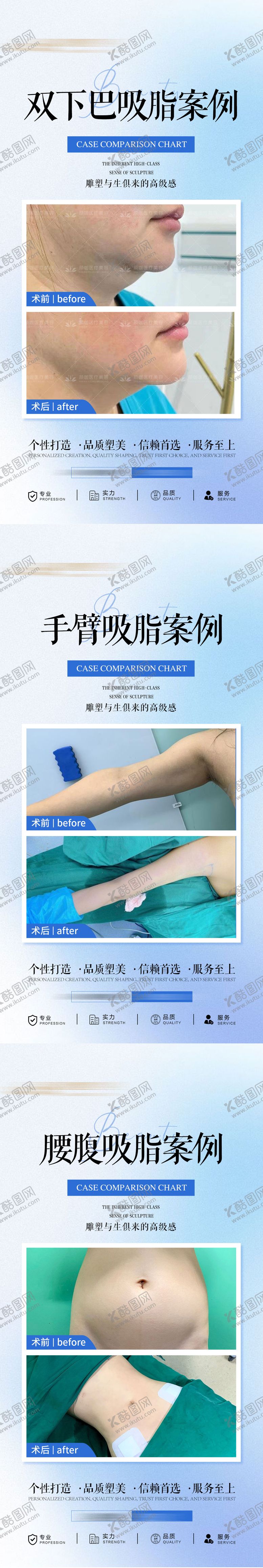 编号：93690406151256505142【酷图网】源文件下载-医美吸脂案例系列海报