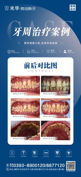 口腔案例对比海报