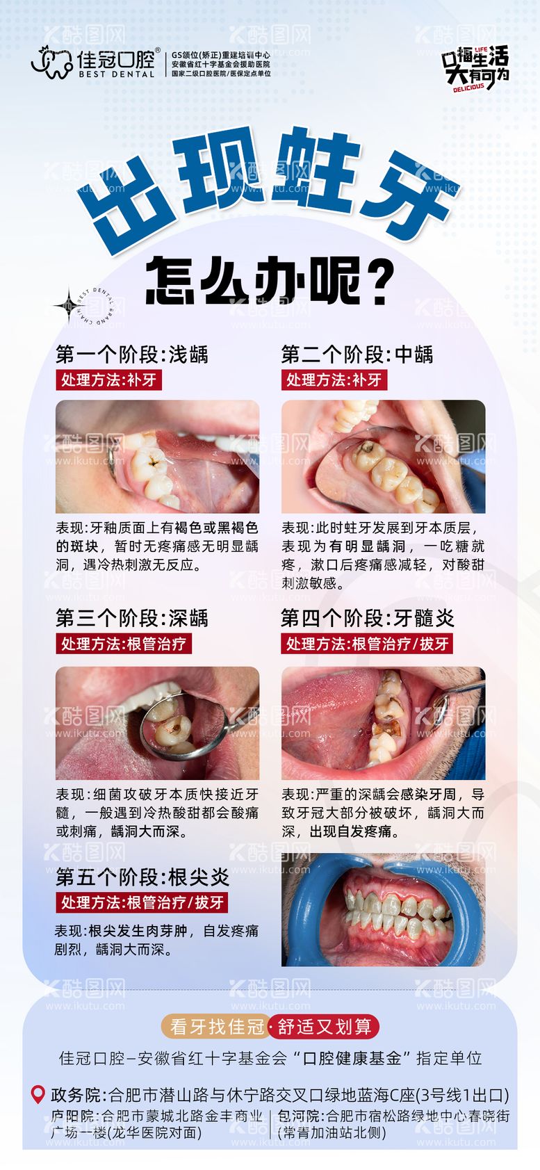 编号：59328411281826128452【酷图网】源文件下载-蛀牙海报