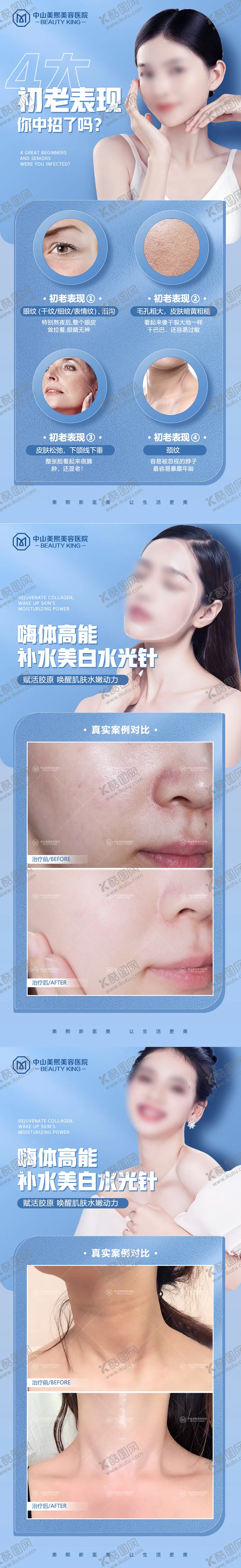 编号：79940611201551291419【酷图网】源文件下载-初老表现水光针案例海报