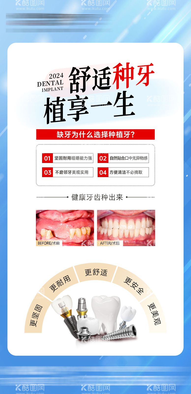 编号：13790412121422003914【酷图网】源文件下载-种植牙品牌海报