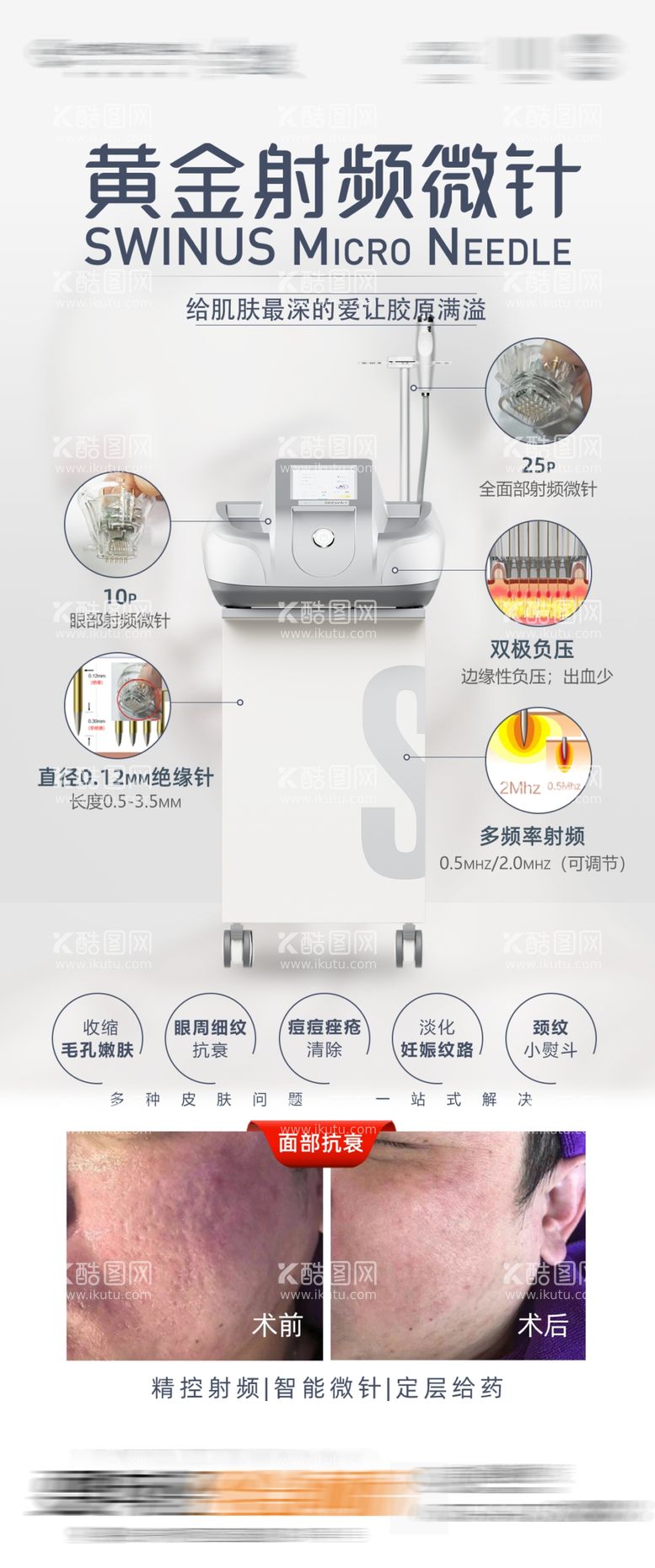 编号：27600302212252412627【酷图网】源文件下载-黄金射频微针