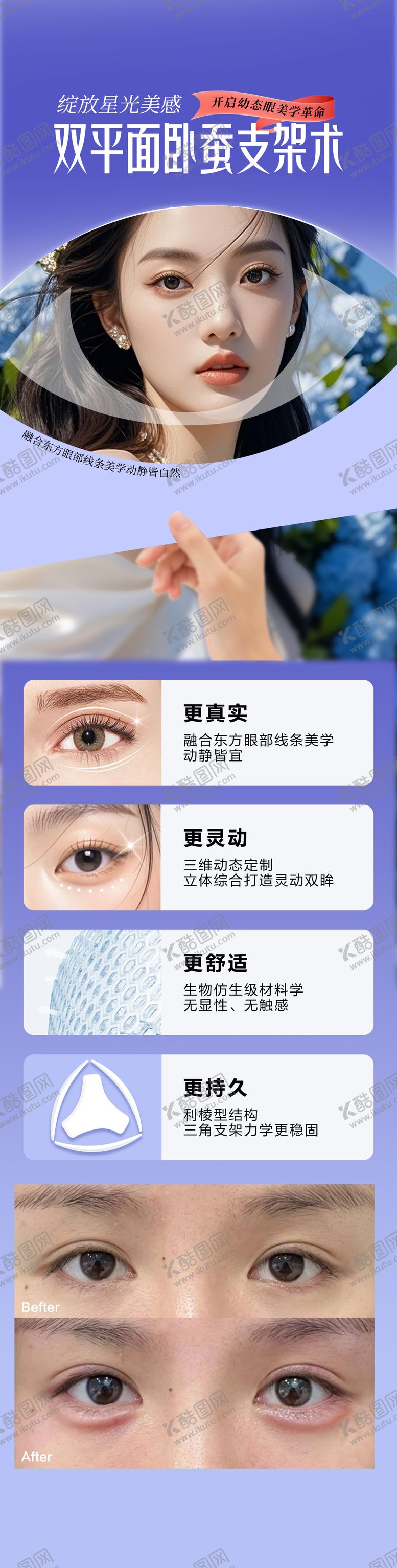 编号：37773510050503385395【酷图网】源文件下载-双平面卧蚕支架术