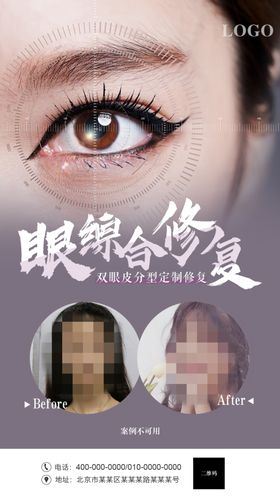 眼修复