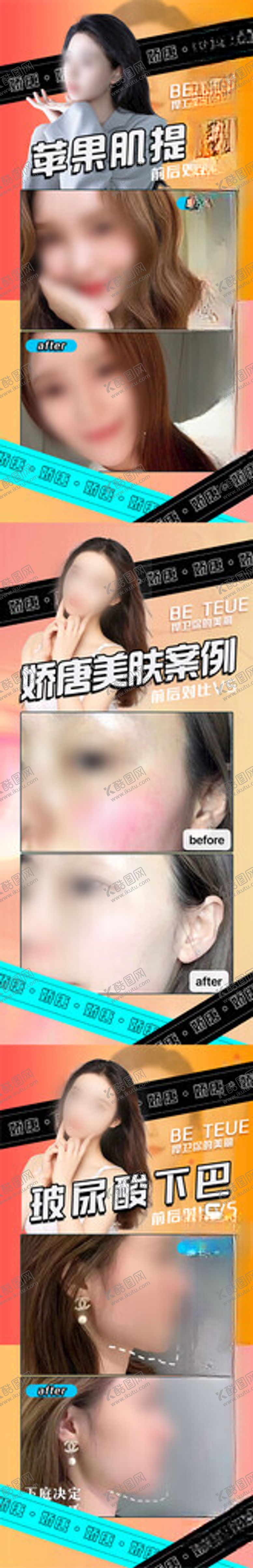 编号：21782201251731546206【酷图网】源文件下载-医美案例对比