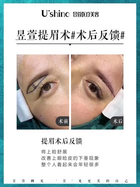 医美整形医院案例对比海报