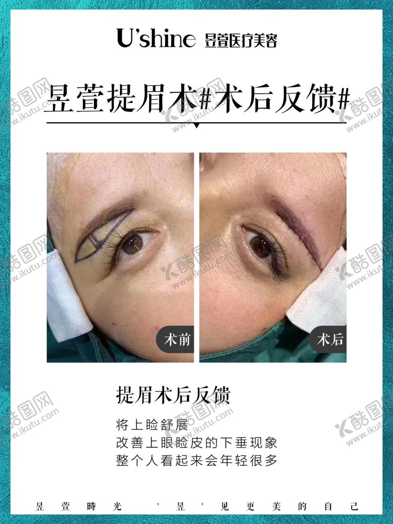 编号：38708710271339311236【酷图网】源文件下载-医美整形医院案例对比海报