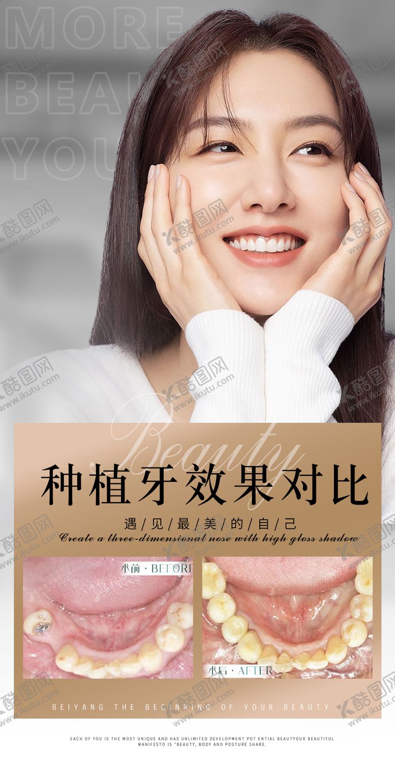 编号：57171206301551207527【酷图网】源文件下载-医美口腔案例种植牙海报