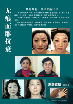 热玛吉霍总组图