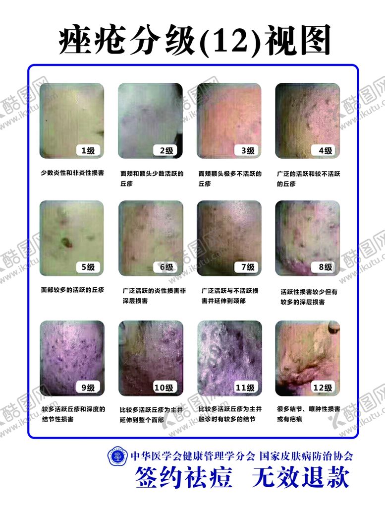 编号：75111510020535288982【酷图网】源文件下载-痤疮分级图痤疮12视图