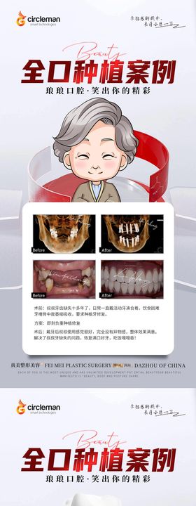 种植口腔专家案例海报长图