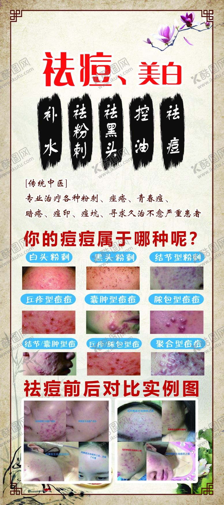 编号：26495410071645332567【酷图网】源文件下载-祛痘美白美容养生