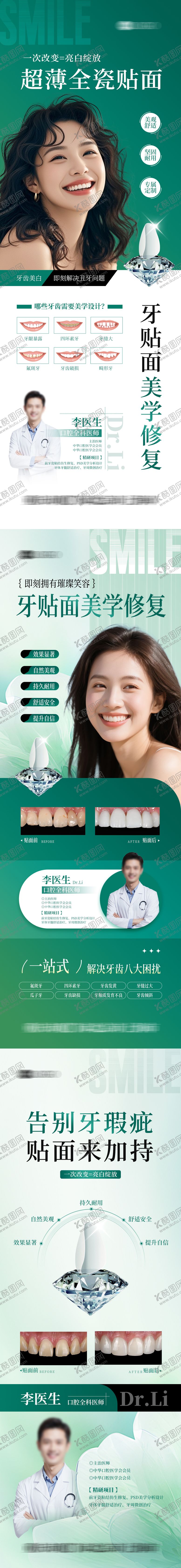 编号：72609202041742343788【酷图网】源文件下载-牙贴面案例 