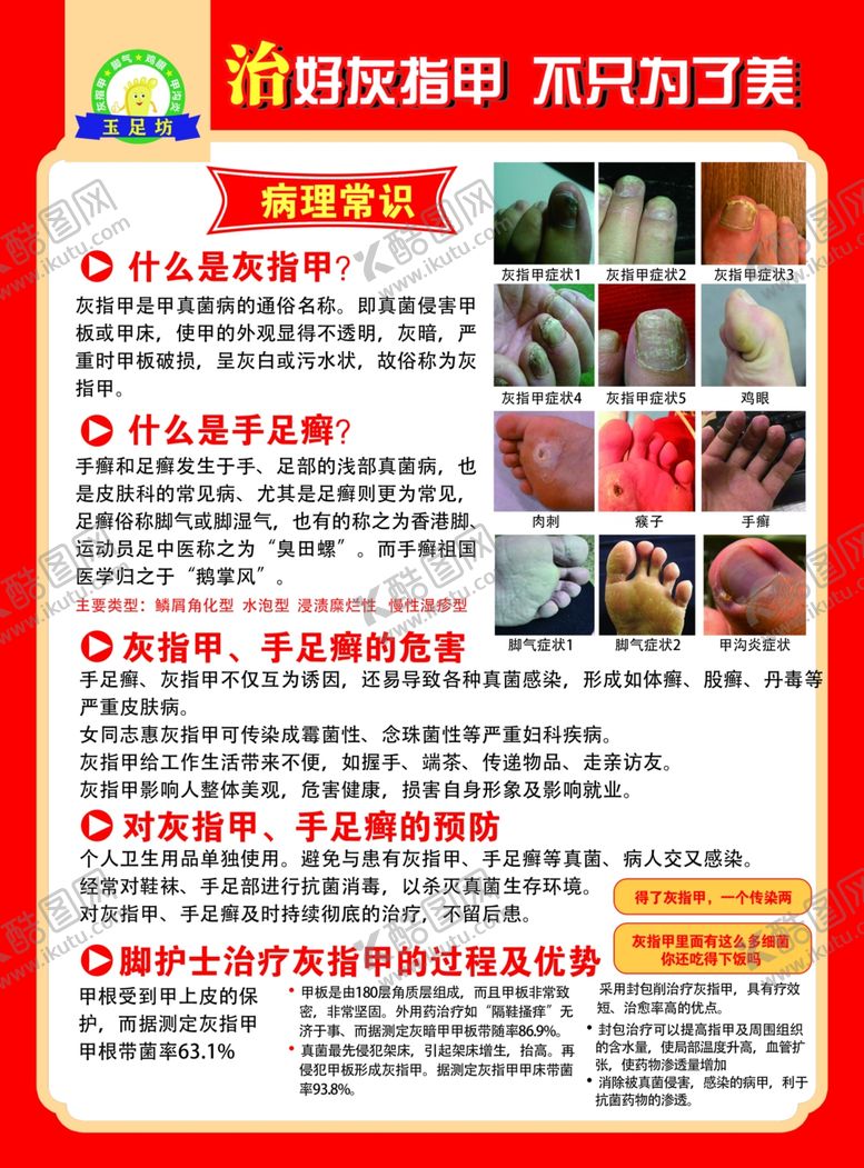 编号：22628807121105497441【酷图网】源文件下载-修脚灰指甲