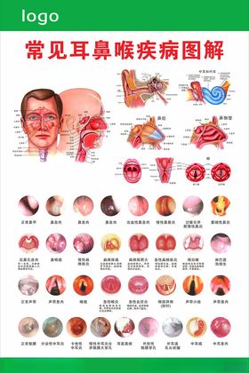 耳鼻喉疾病图谱