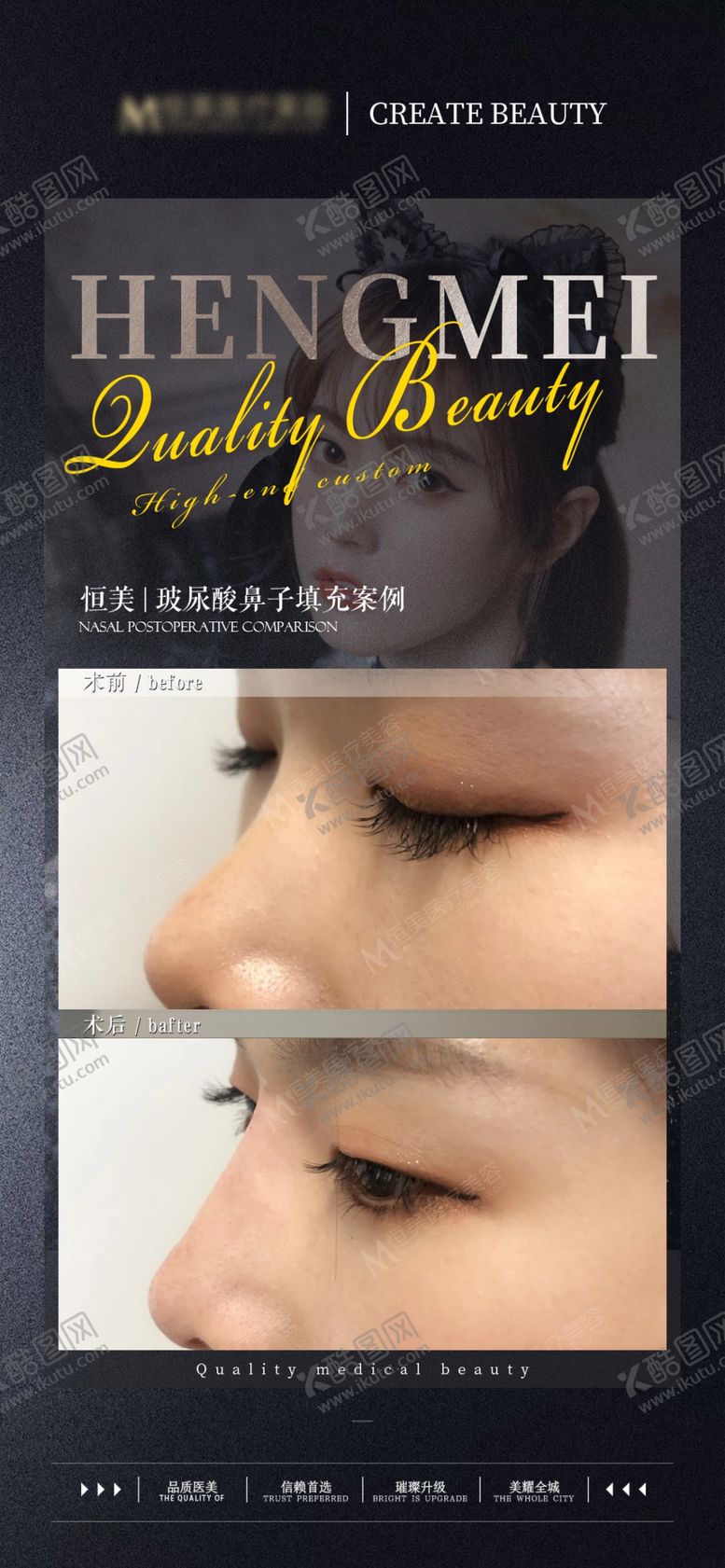 编号：95990201181912212681【酷图网】源文件下载-医美整形隆鼻案例鼻注射