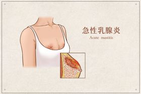 急性胸痛的诊断及鉴别诊断流程图