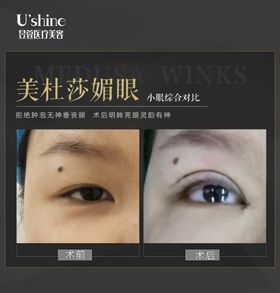 医美整形医院案例对比海报