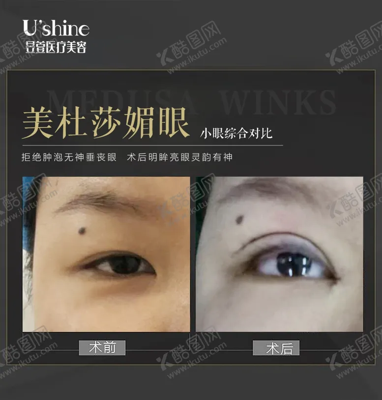 编号：11425006241953344005【酷图网】源文件下载-医美整形医院案例对比海报