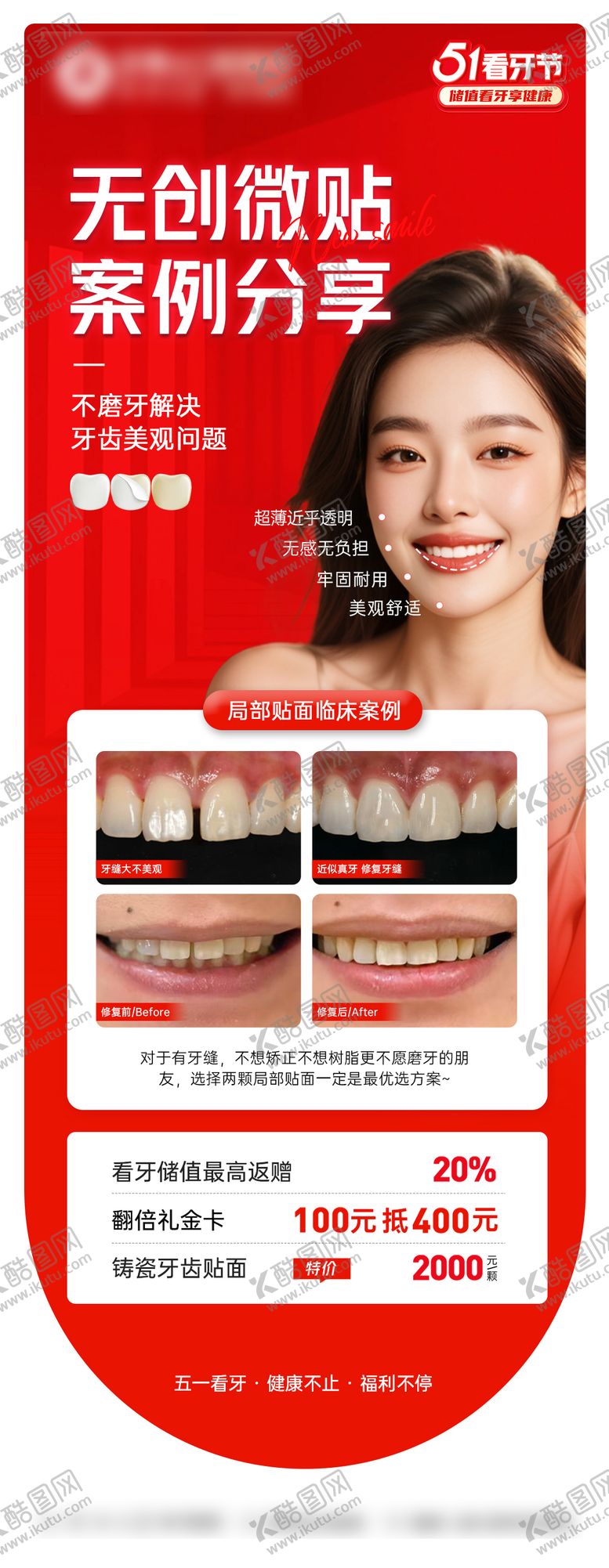 编号：64173509221713444128【酷图网】源文件下载-美白瓷贴面案例宣传海报