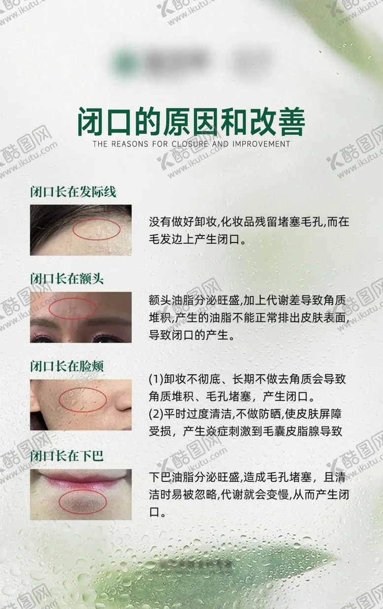 编号：76279502081924208247【酷图网】源文件下载-肌肤闭口痘痘科普海报