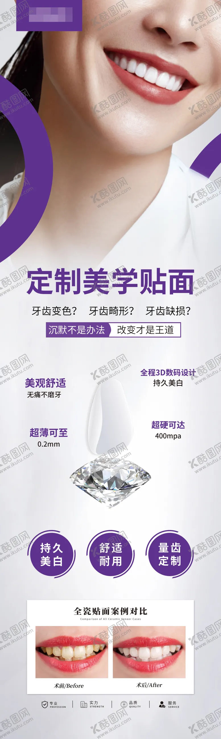编号：46913504190849212588【酷图网】源文件下载-牙齿贴面海报