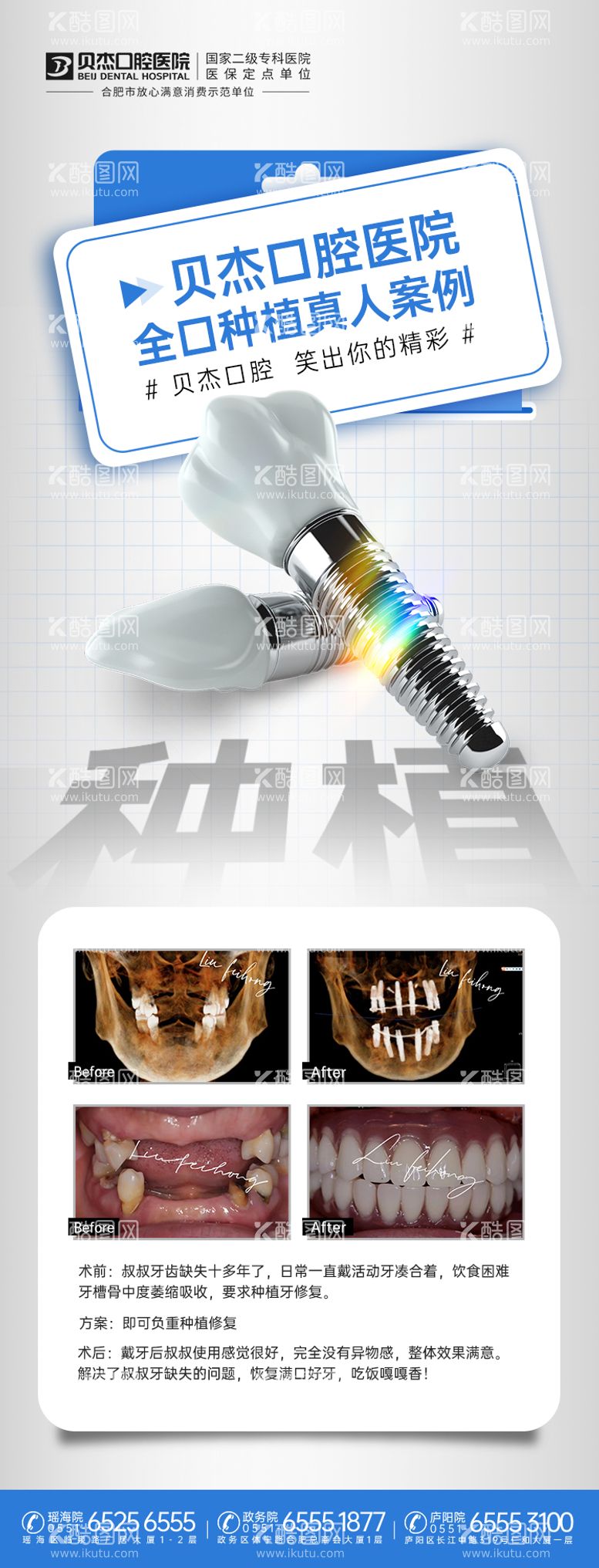 编号：57046411190558207387【酷图网】源文件下载-种植牙