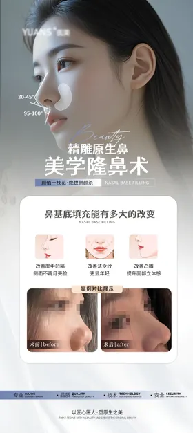 医美隆鼻科普案例海报
