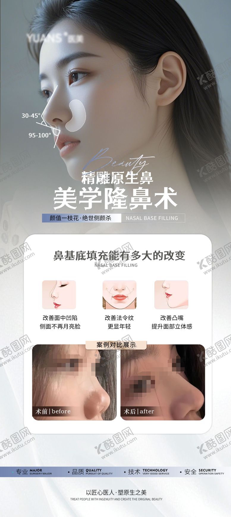 编号：11189601231439024502【酷图网】源文件下载-医美隆鼻科普案例海报