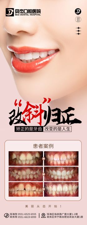 牙齿矫正牙齿健康牙齿美容展架